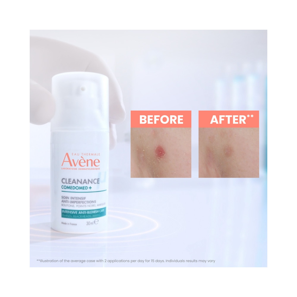 Avène Cleanance Comedomed+