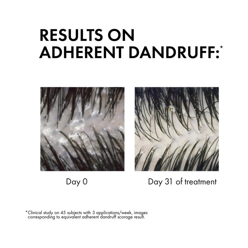 Vichy Dercos Anti Dandruff
